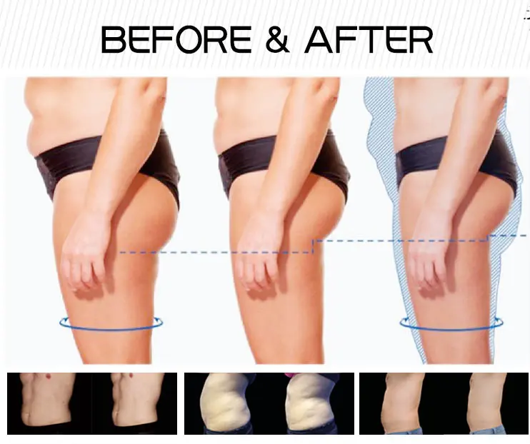 Treatment Result