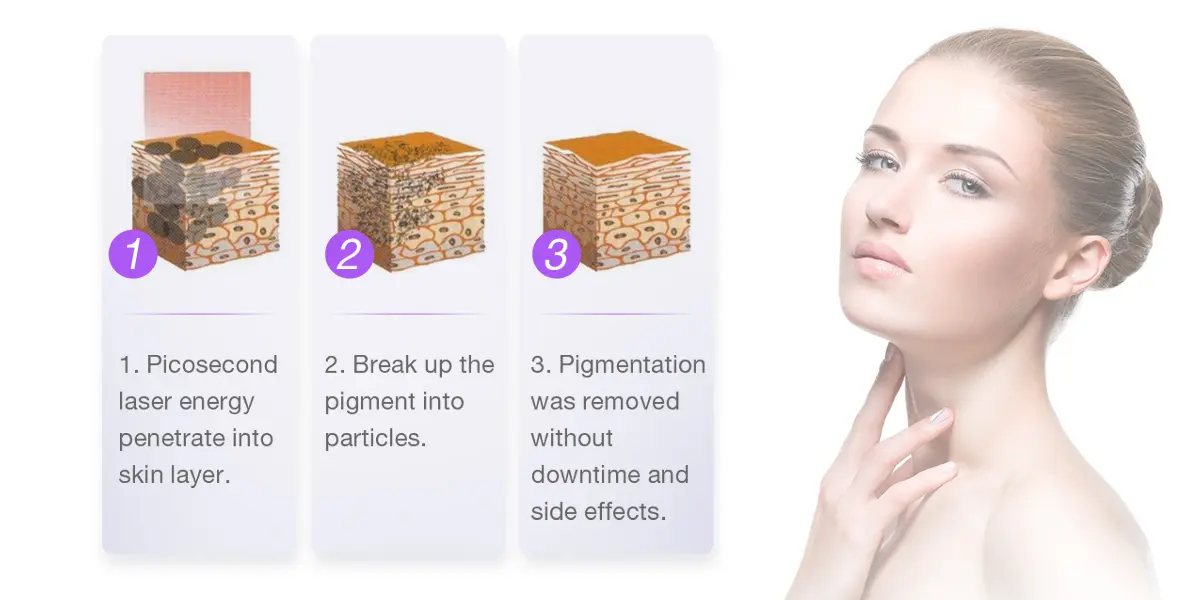Treatment Principle Diagram