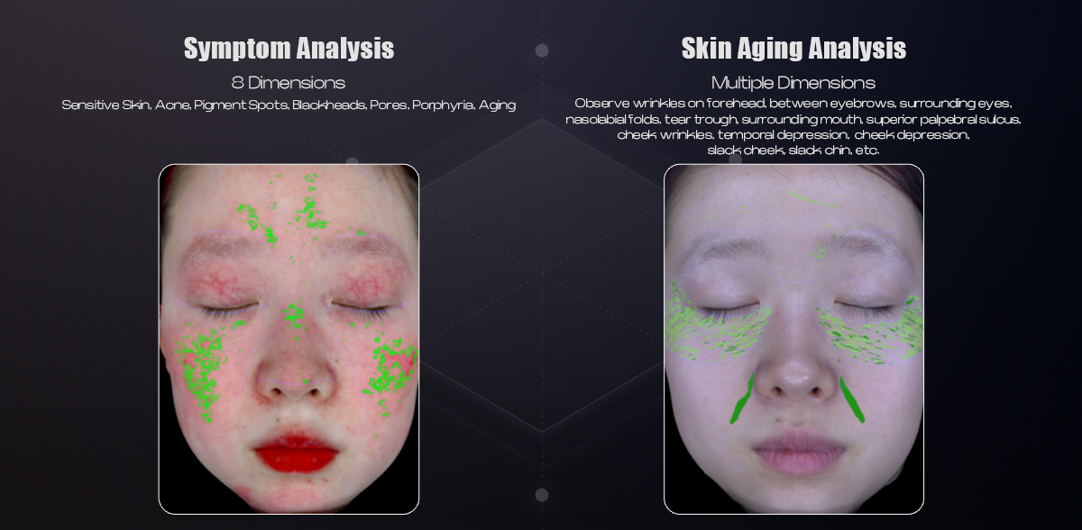 Skin Aging Analysis