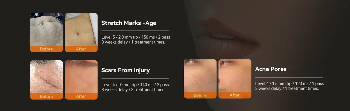 Treatment Effect Results