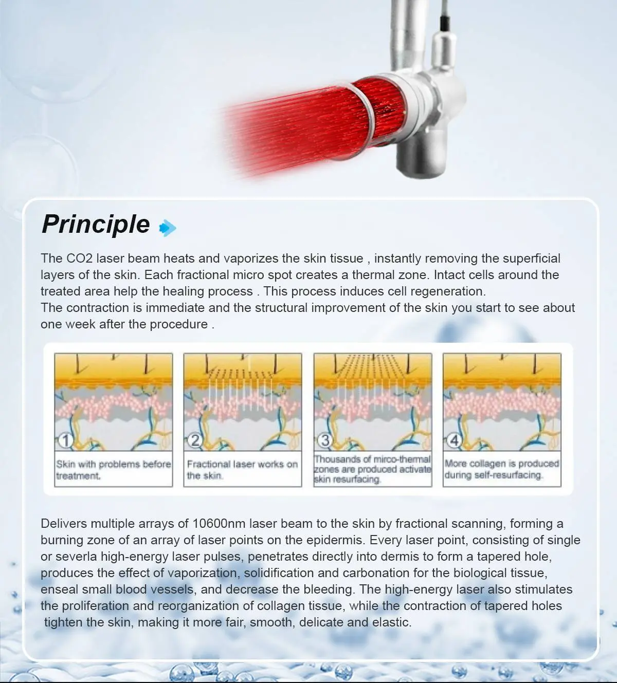 CO2 Laser Working Principle