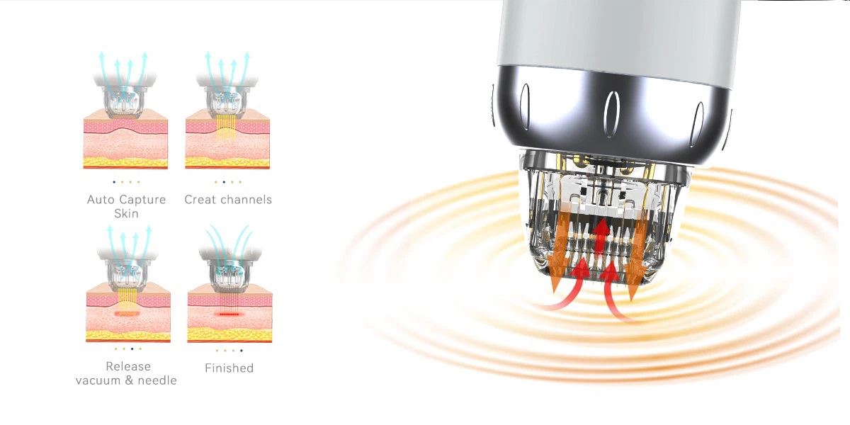 Vacuum Advantage System