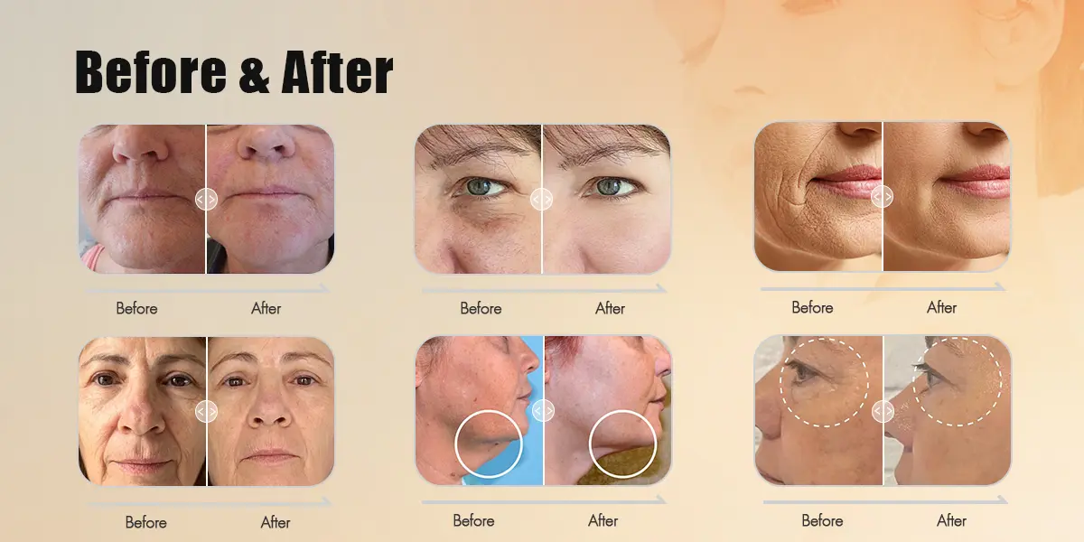 Before and After Results