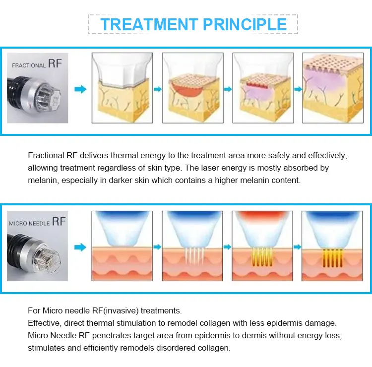 SFR Collagen Induction Mechanism 1