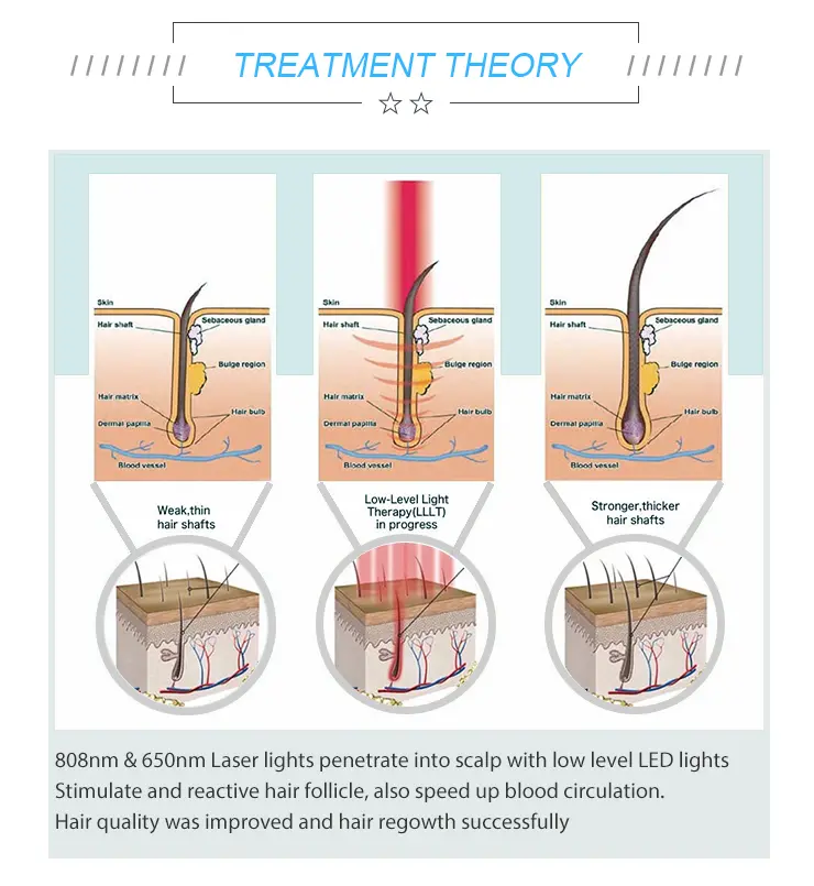 SH650-1 Laser Hair Therapy Device Detail