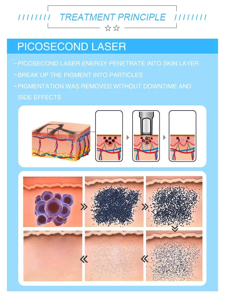 Pico second laser wavelength details