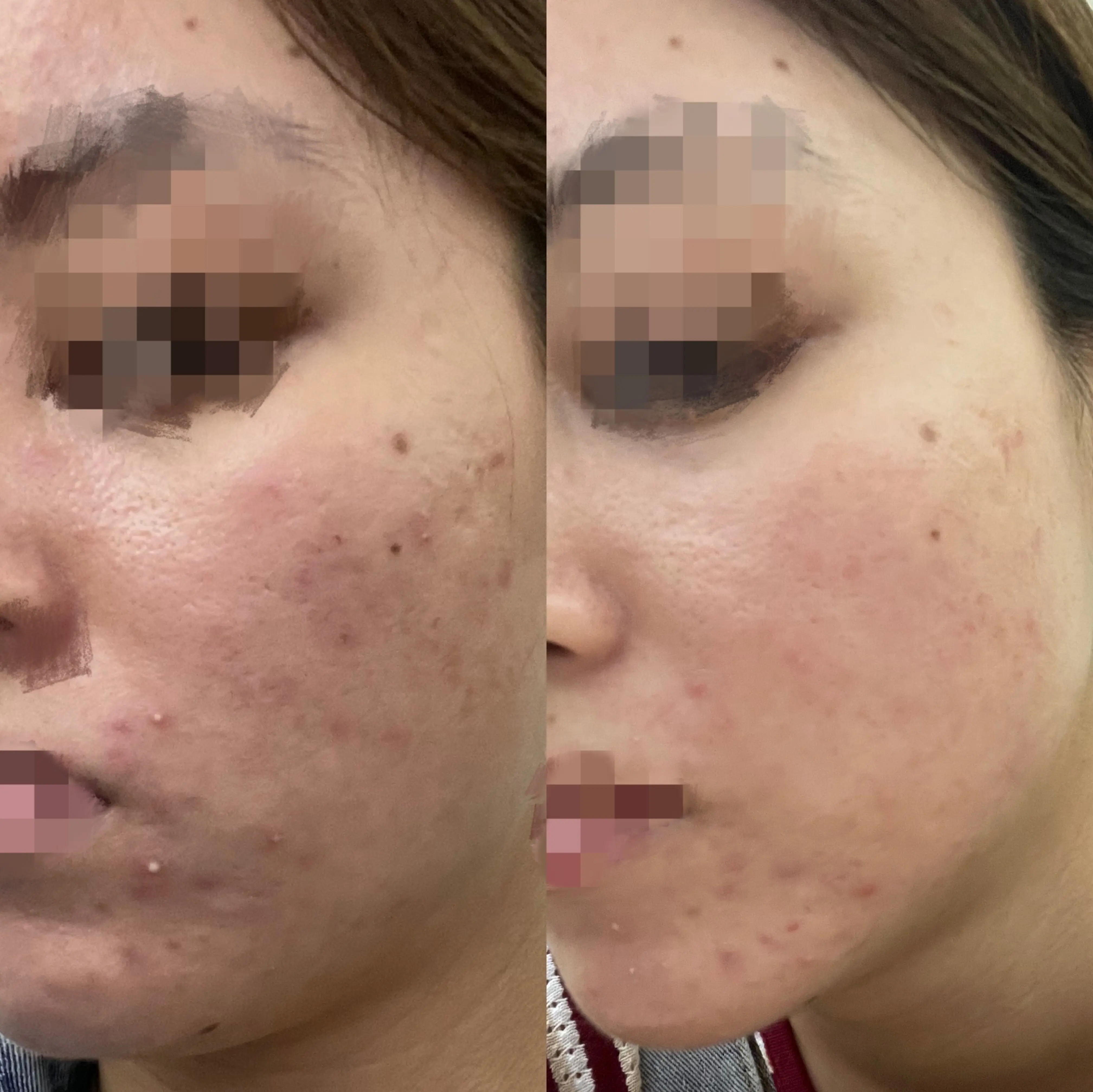 Before and After 3
