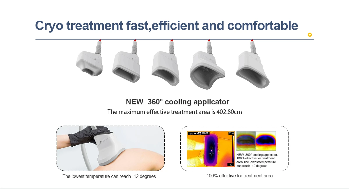 Cryo treatment fast, efficient and comfortable