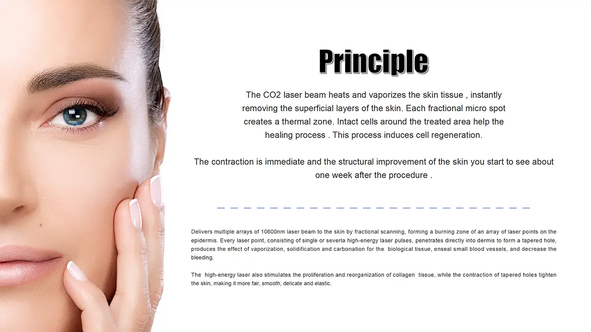 co2 laser skin machine