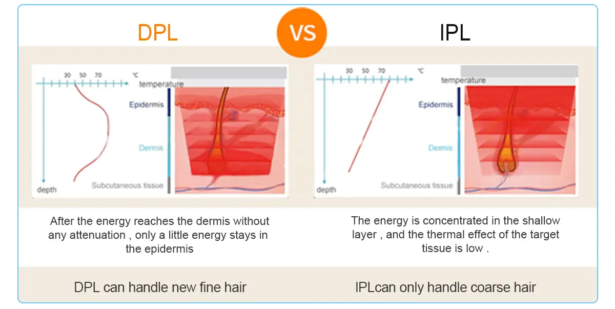 dpl machine