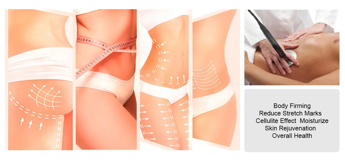Body Treatment Application