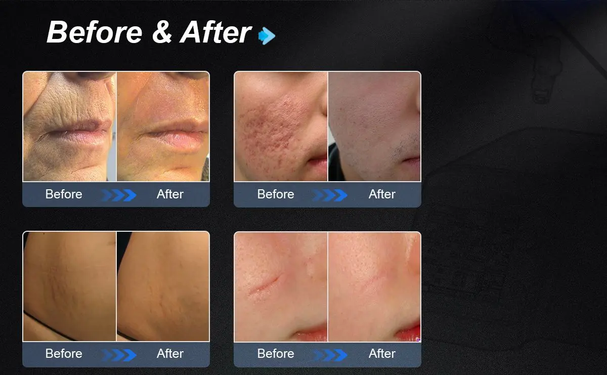 Before and After Treatment Results
