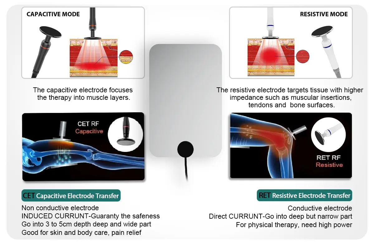 CET and RET comparison