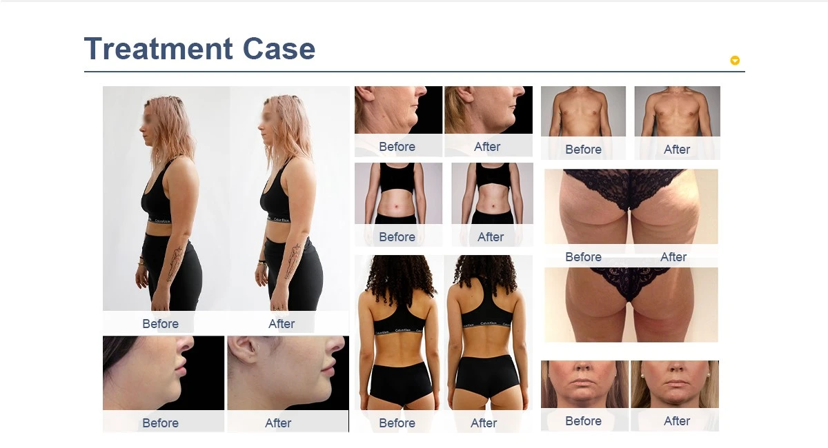 Before and After Results