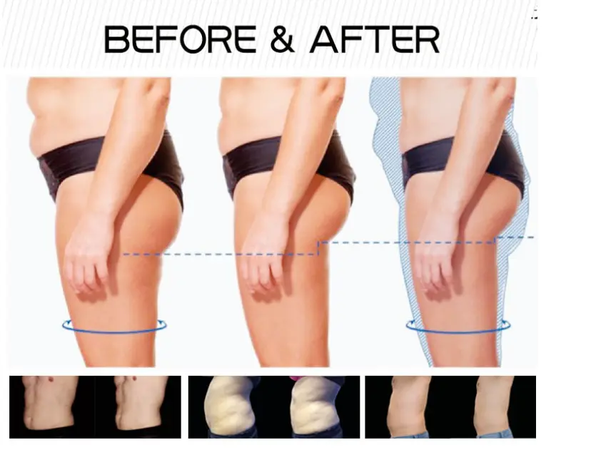 Before and after picture