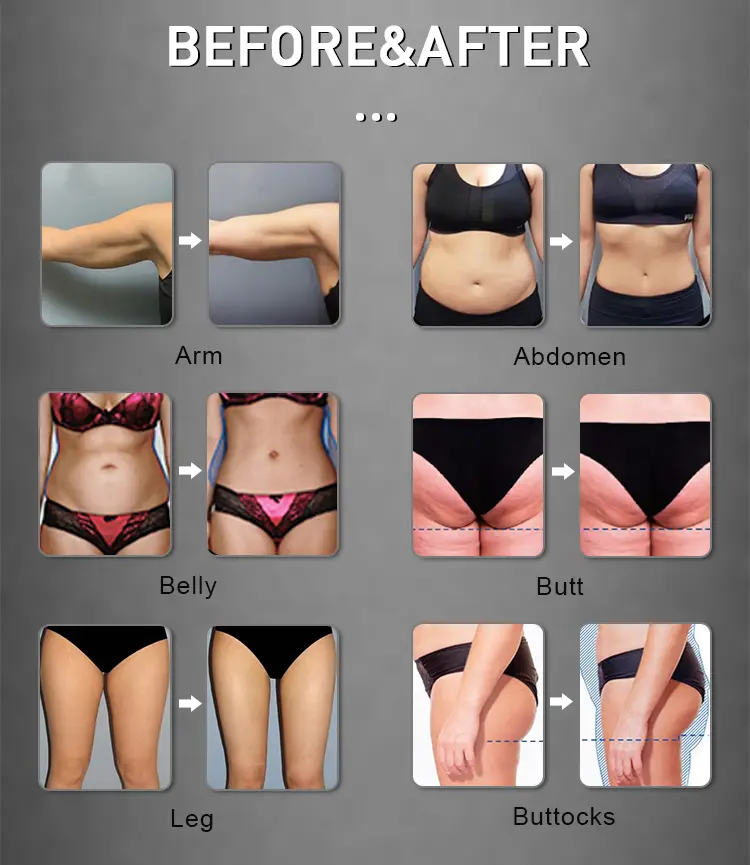 Treatment Effect Description