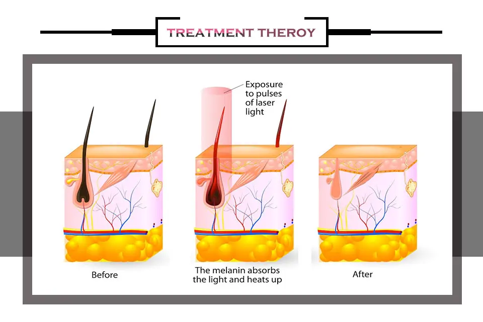 Treatment Areas Demonstration