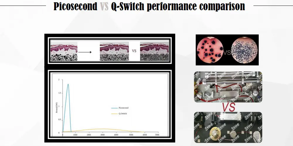 Picosecond Laser Principle