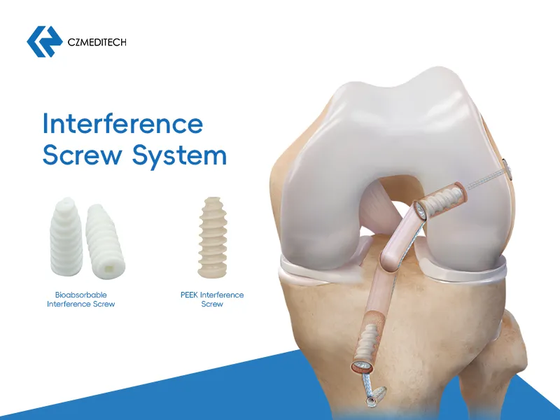 Biocompatible Screws