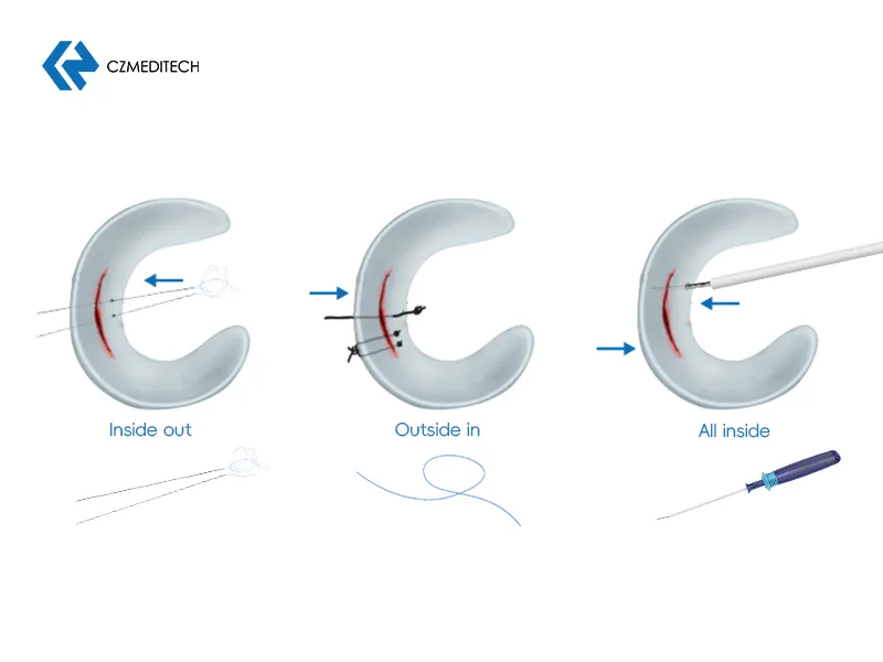 Meniscus Repair Tool