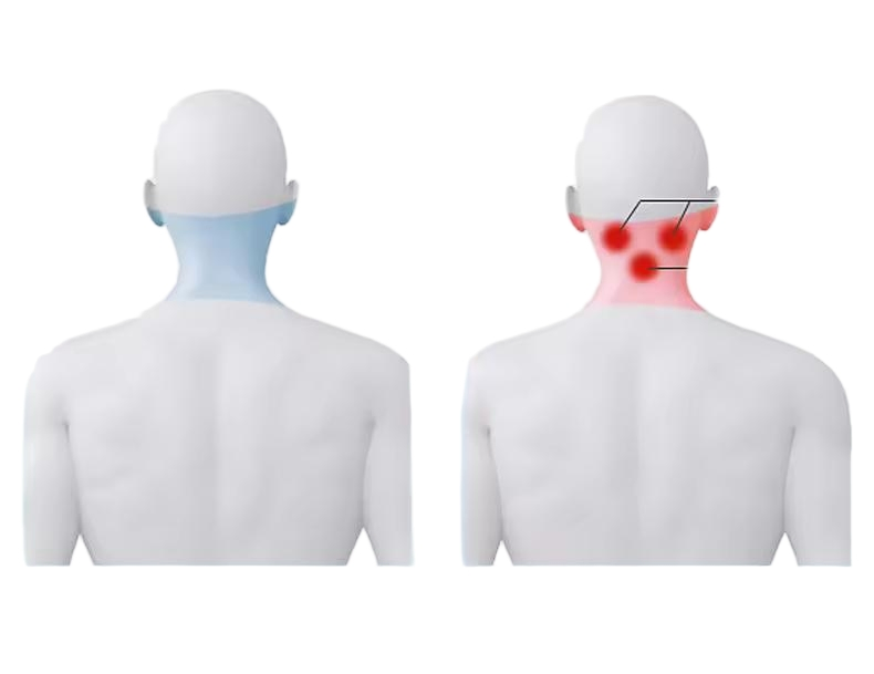 Personalized Tms Therapy Solutions for Right-Handed Mental Wellness