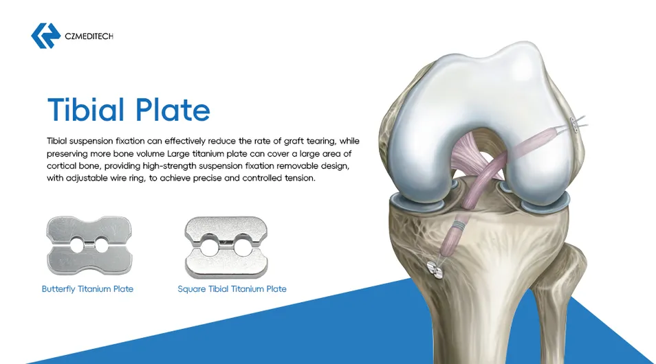 Knotless Button Detail