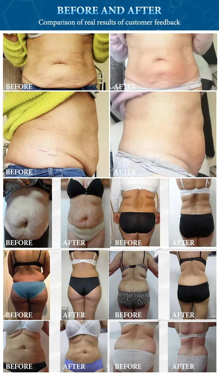 Before and After Effect