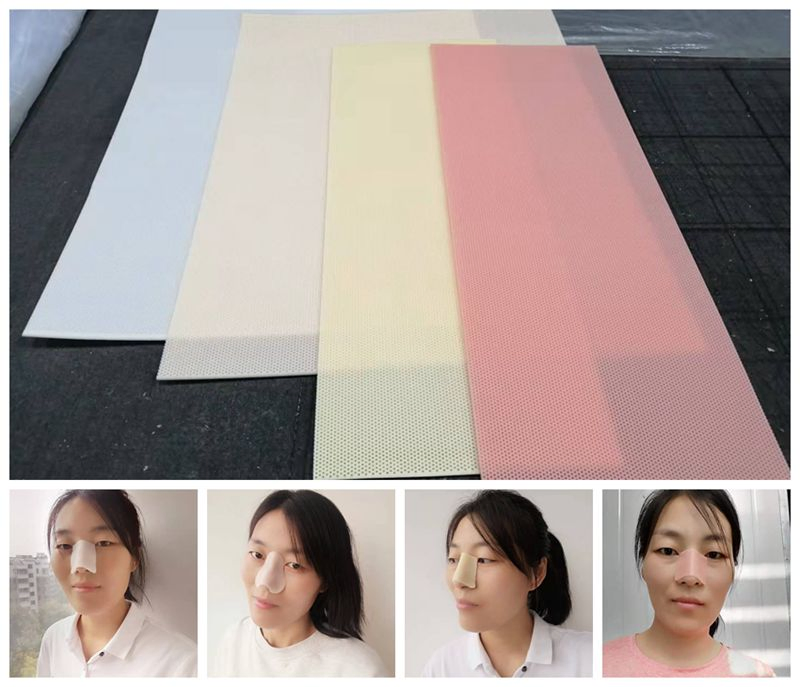 Perforated Thermoplastic Board in Post-Rhinoplasty Surgery Nose Splint Material