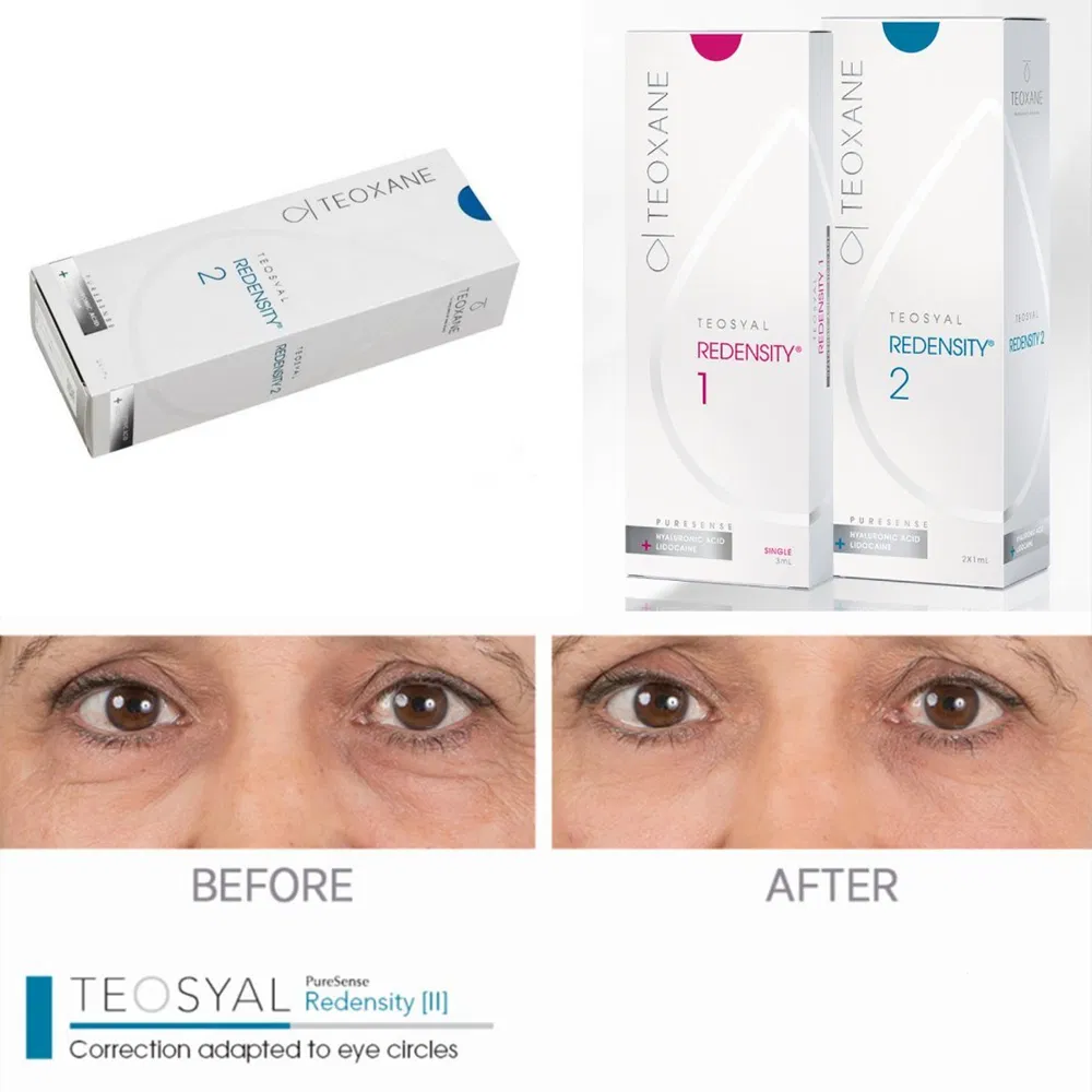 Teosyal Redensity 2 Product