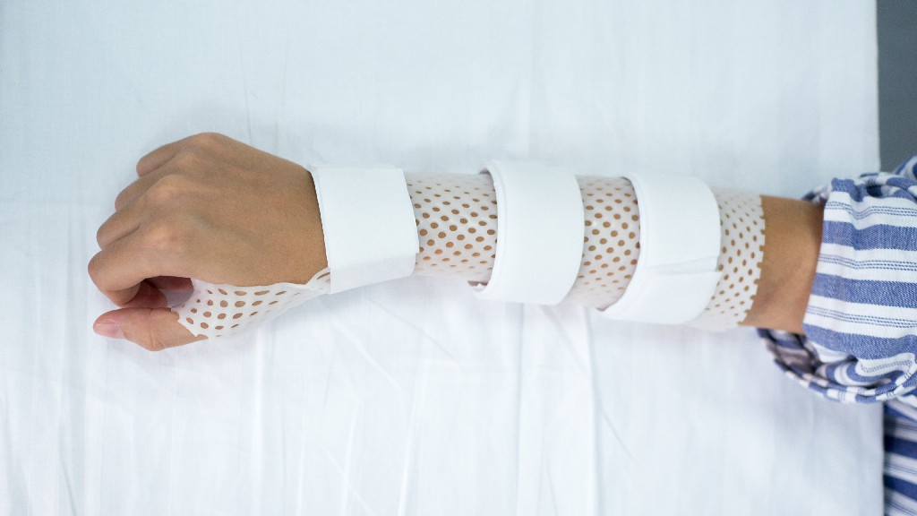 Wrist Splint Thermoplastic Splinting Material for Wrist Support (Type I)