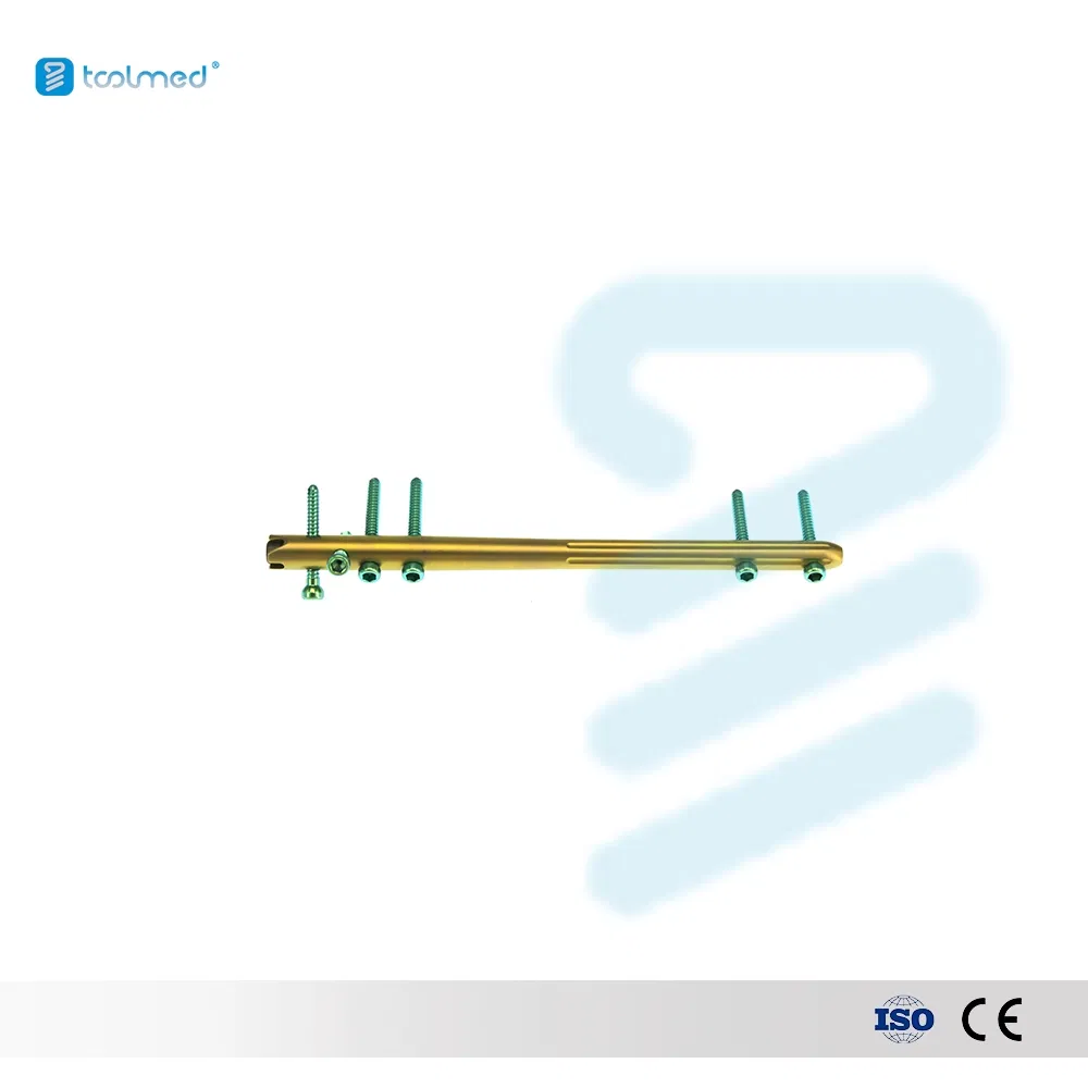 Multifunction Intramedullary Femoral Nail Orthopedic Trauma Implant Interlocking Intracortical Implant Interventional Material 11*160