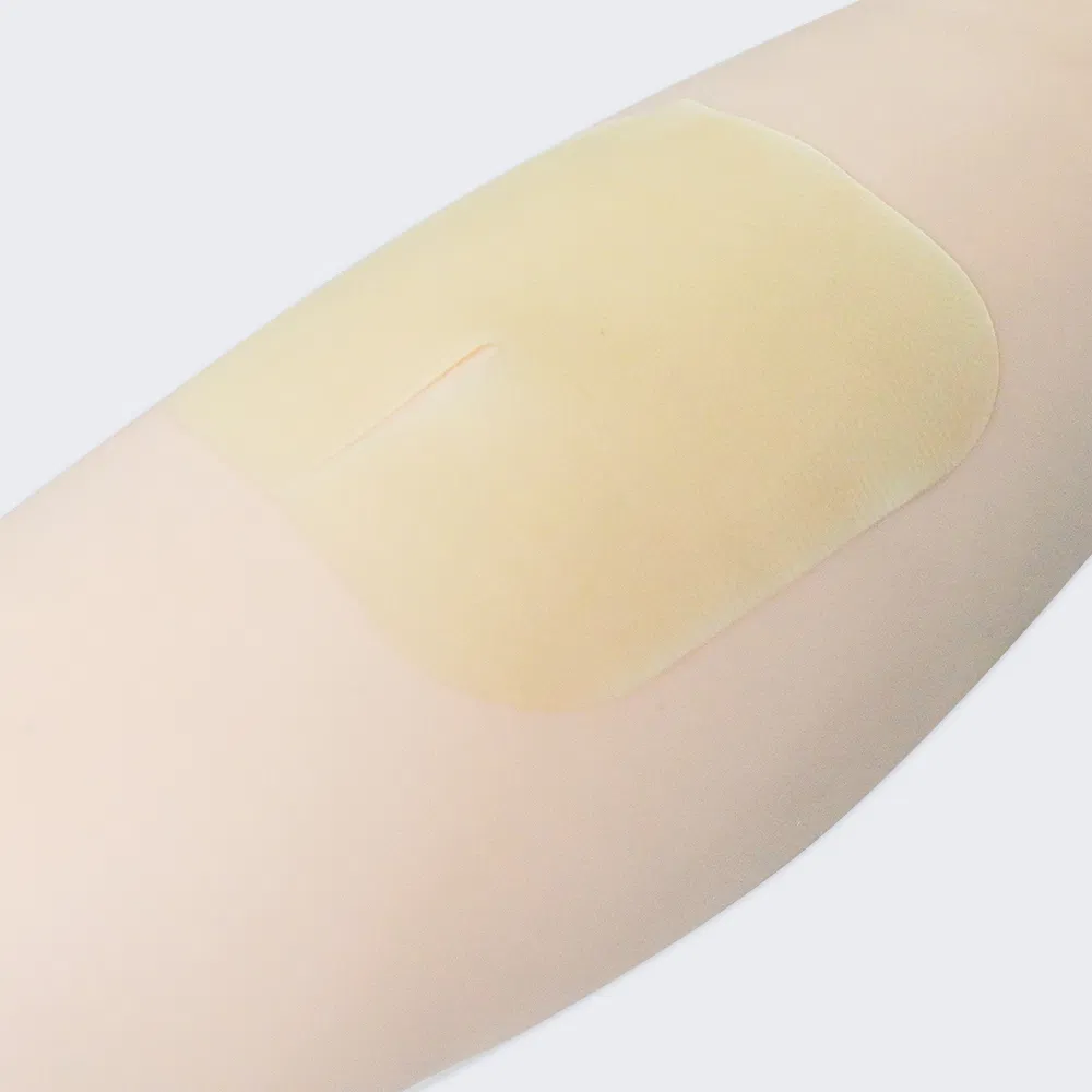 Waterproof Self Adhesive Hydrocolloid Wound Dressing Hydrocolloid Patch Bandages for Bed Sore Catheter Fixation