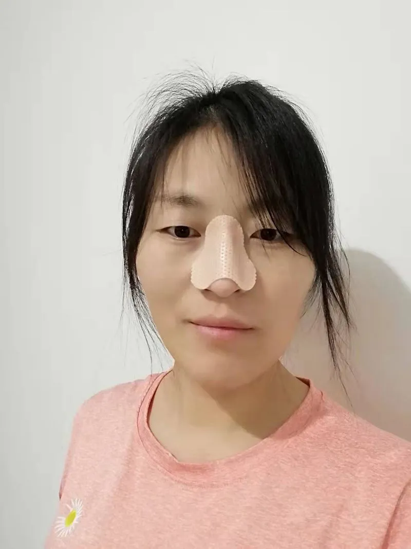 Thermoplastic Material Detail 2