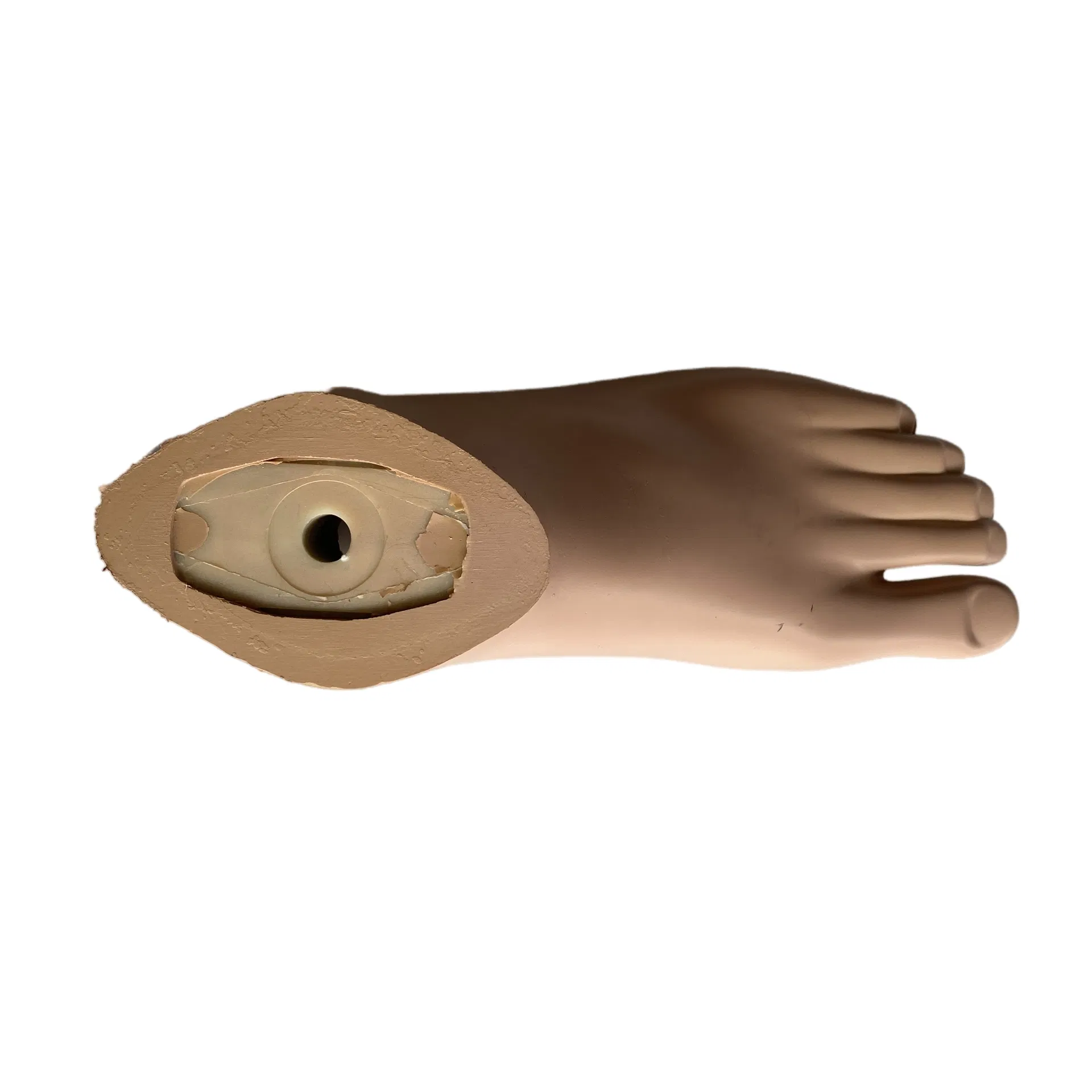 Sach Foot Prosthetic Solution 5