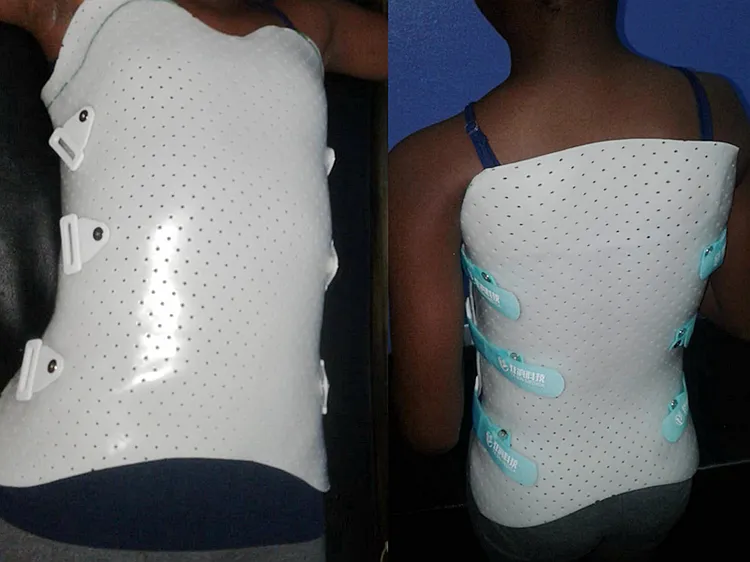 Thermoplastic application