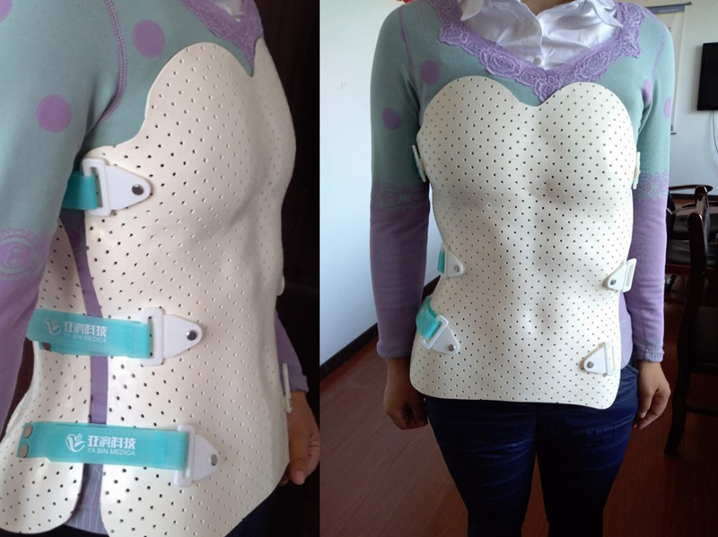 Thermoplastic Orthopedics Physiotherapy Splint for Neck Chest Waist Back Brace Bandage Support Immobilization Rehabilitation