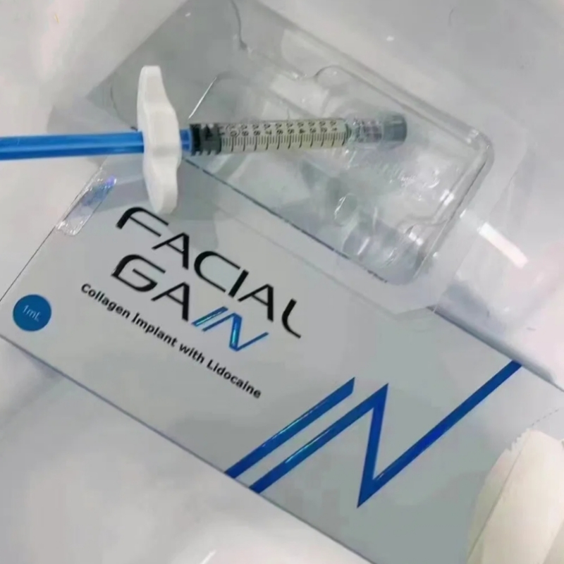 Facial Gain Premium Injectable Facial Fillers for Eye Wrinkles Dark Circles Tear Troughs Dermal Filler Collagen Implants Sunmax Facial Gain Teosyal Redensity 2