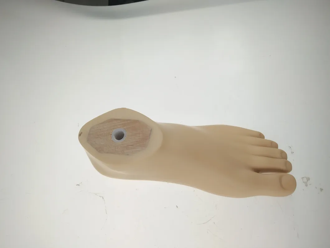 Prosthesis Solution 2