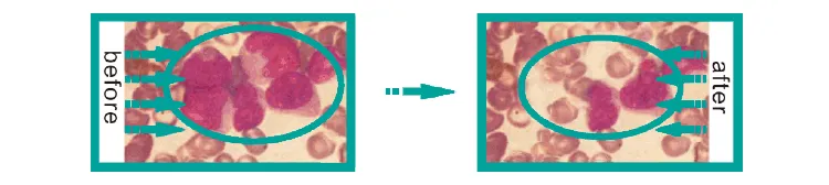 Circulation Improvement