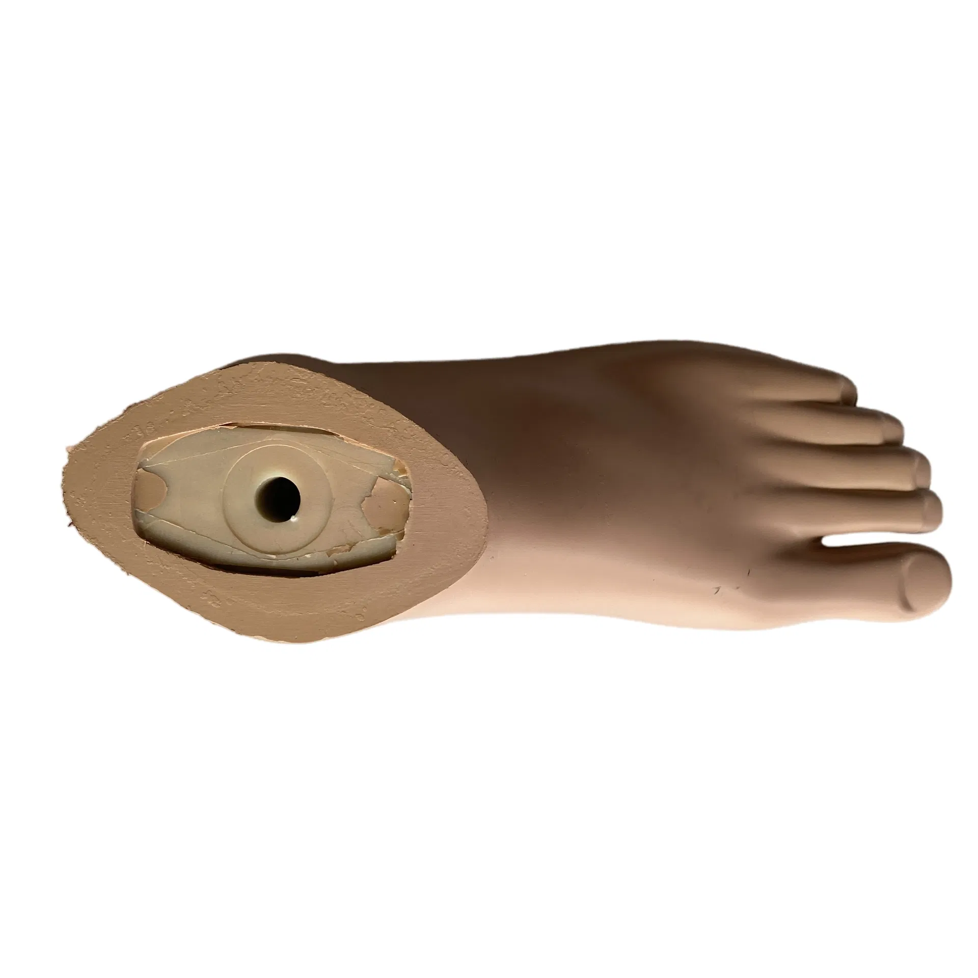 Sach Foot Prosthetic Solution 1