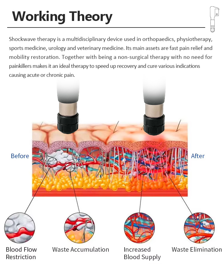 Cellulite Reduction &amp; Sports Injury Recovery Pain Relief Pneumatic Shockwave Therapy