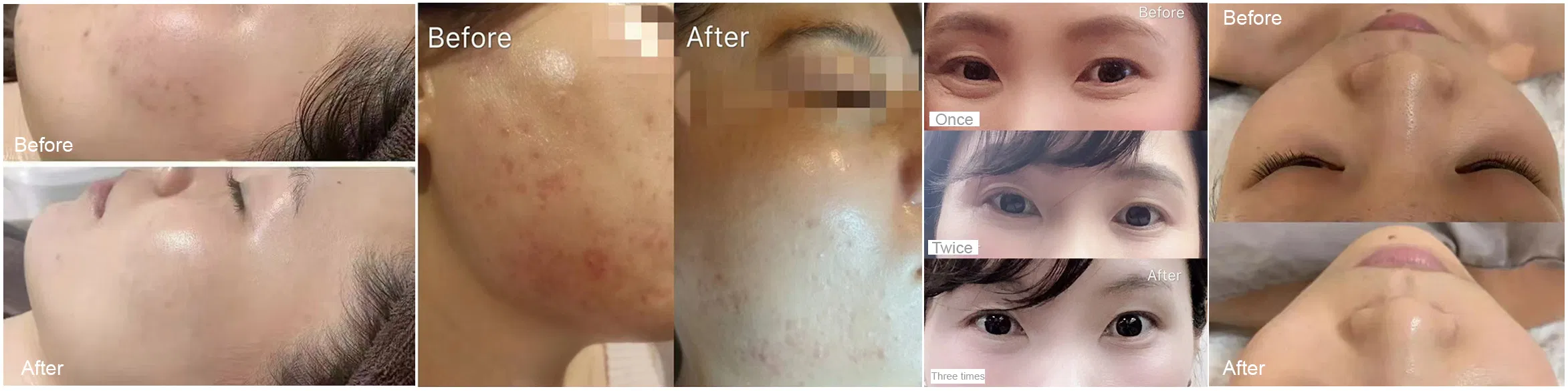 Model 002- 98% Hydrolyzed Sponge /Spicule Raw Materials for Cometics 1kg