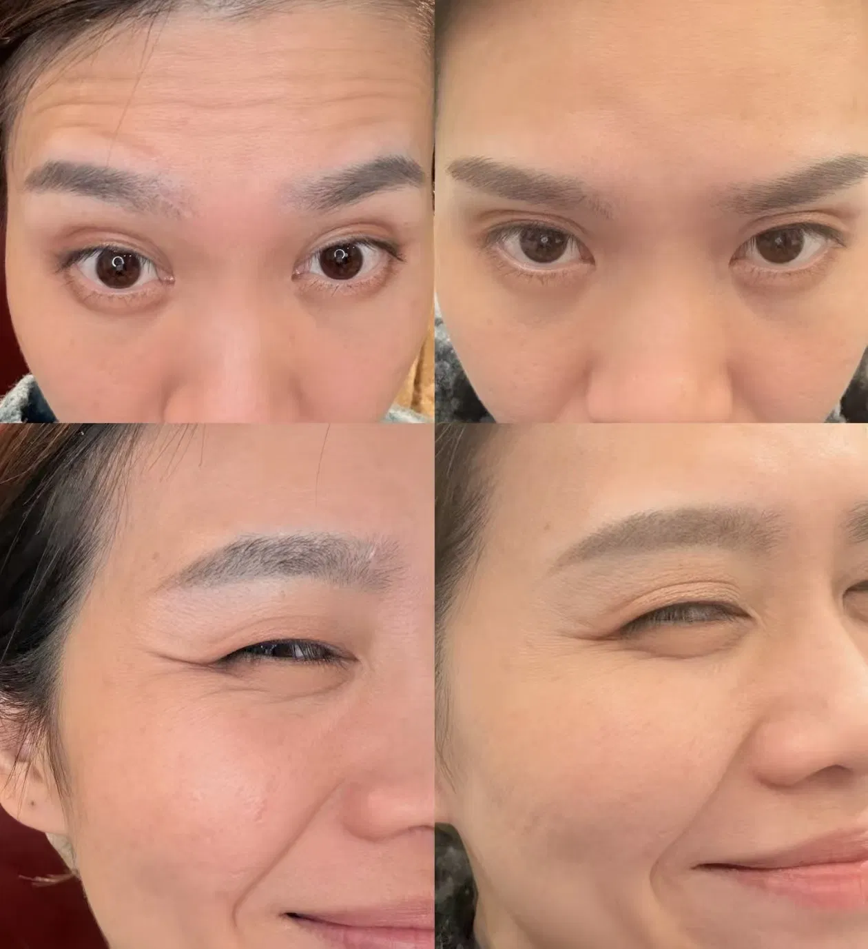 Creapep Palmitoyl Tripeptide-5 Collagen Promoter Anti-Aging Peptide Cosmetic Raw Material