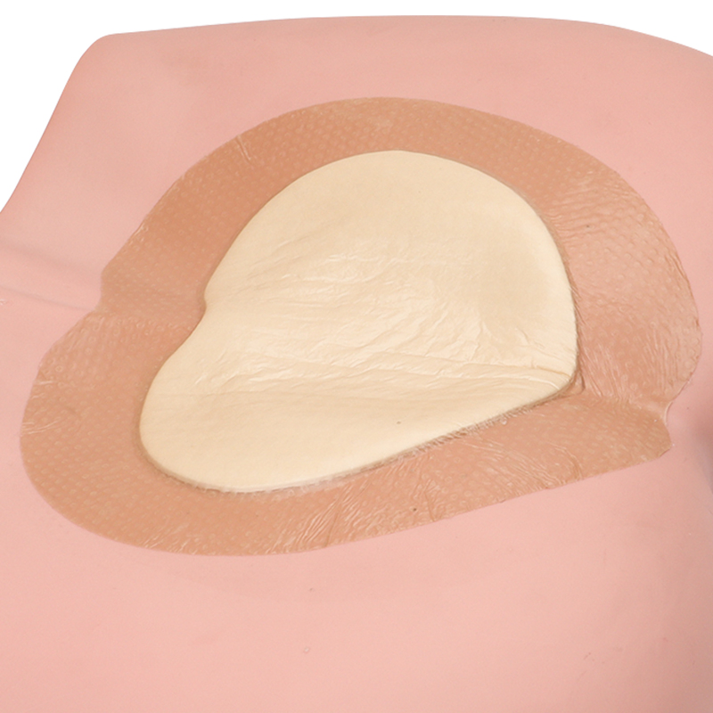 Large Self-Adhesive Foam Bandages for Effective Wound Healing