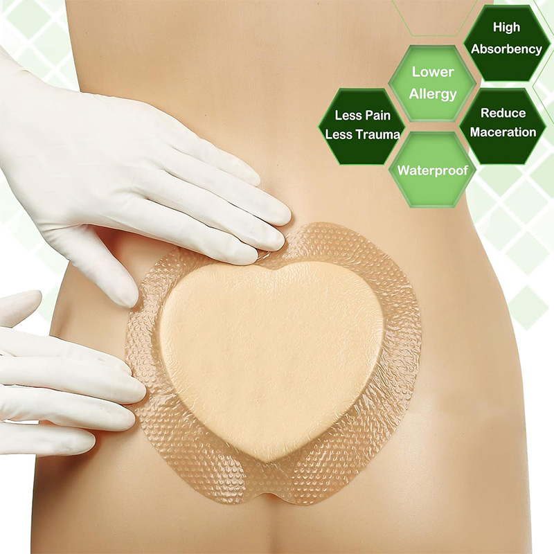 Large Self-Adhesive Foam Bandages for Effective Wound Healing
