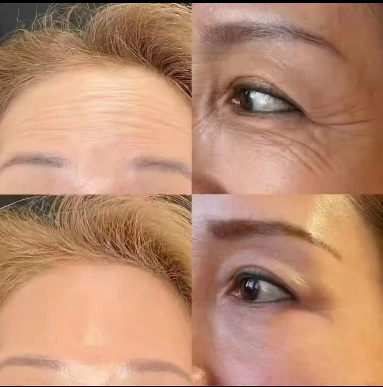 Creapep Palmitoyl Tripeptide-5 Collagen Promoter Anti-Aging Peptide Cosmetic Raw Material