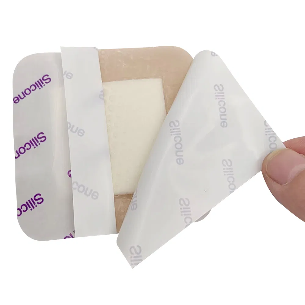 Highly Absorbent Antibacterial Foam Dressings for Wound Care