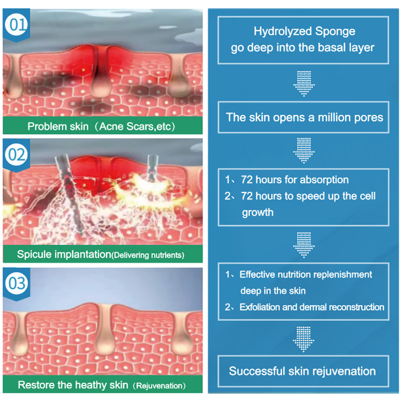 Model 002- 98% Hydrolyzed Sponge /Spicule Raw Materials for Cometics 1kg