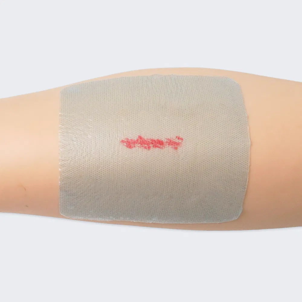 Hydrogel dressing 5