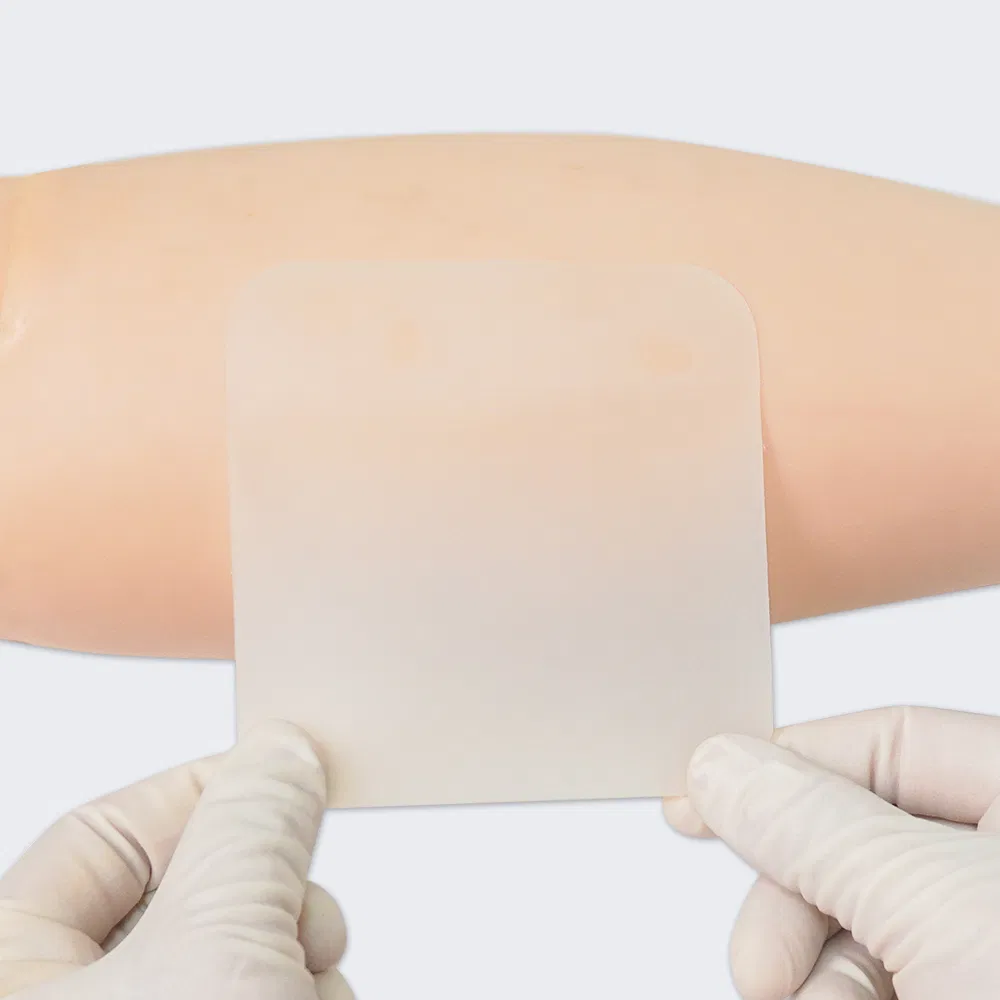 Hydrocolloid Dressing 1